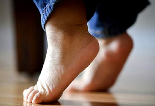 حدود ۵۰ درصد کودکان پیش از سن مدرسه صافی کف پا دارند