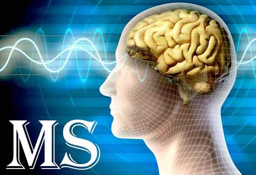 درمان ام‌اس صحت ندارد