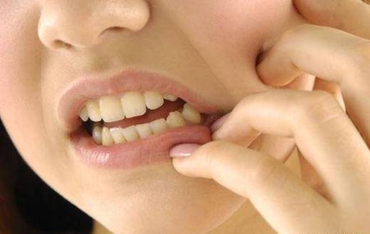 شاخص پوسیدگی دندان ایرانی‌ها از سال ۳۸ ثابت مانده است